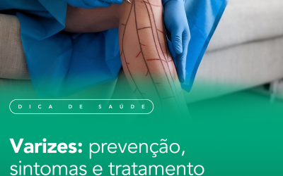 Varizes: prevenção, sintomas e tratamento.